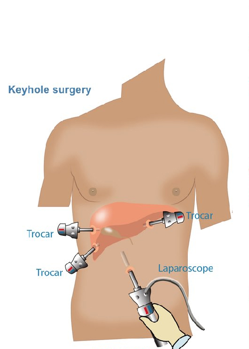 Best Gallbladder Surgeon In Gujarat, Gallbladder Stone Treatment In Ahmedabad, Gallbladder Stone Removal Doctor Near Me